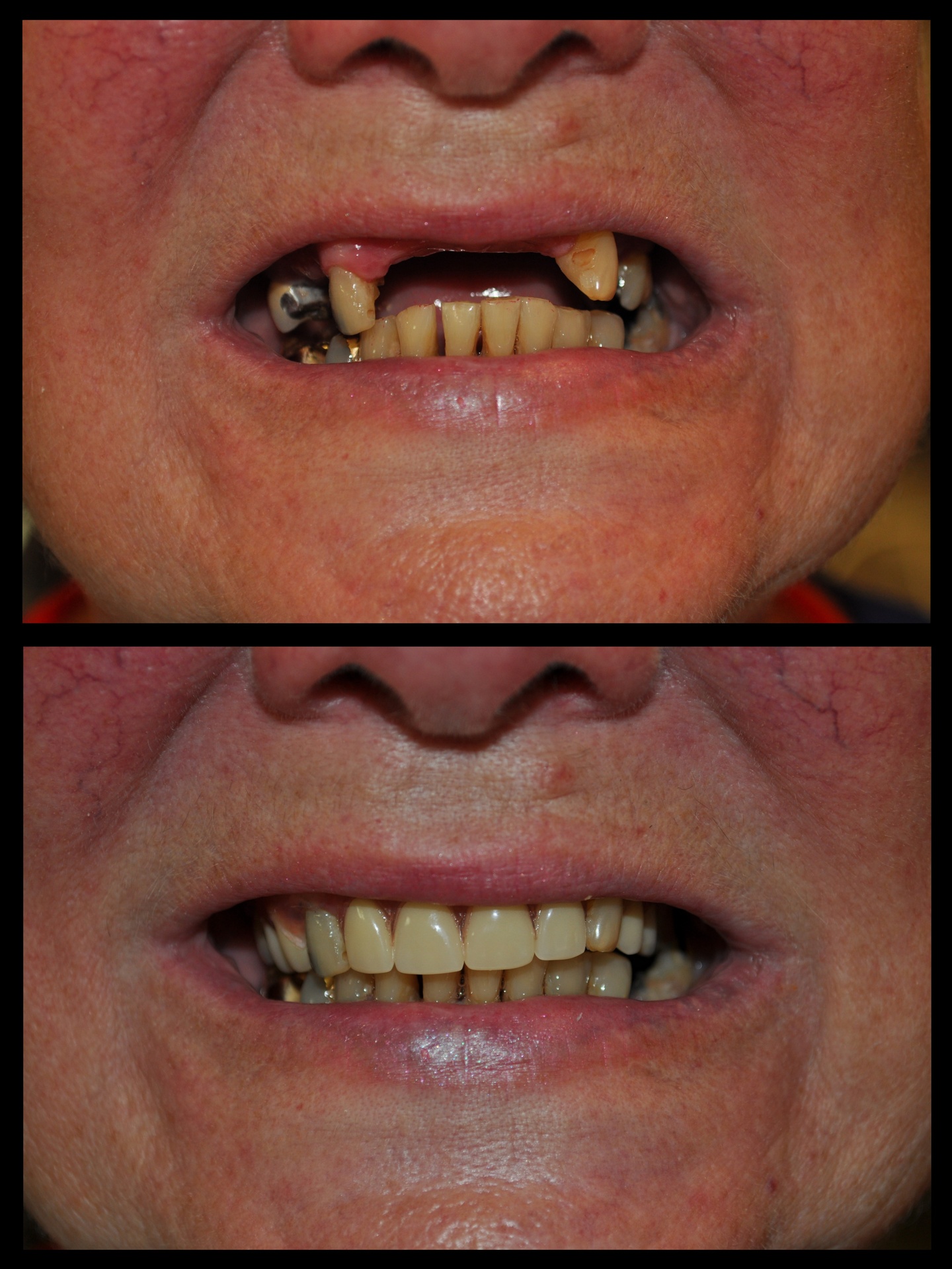 SDDS Dental Before and After