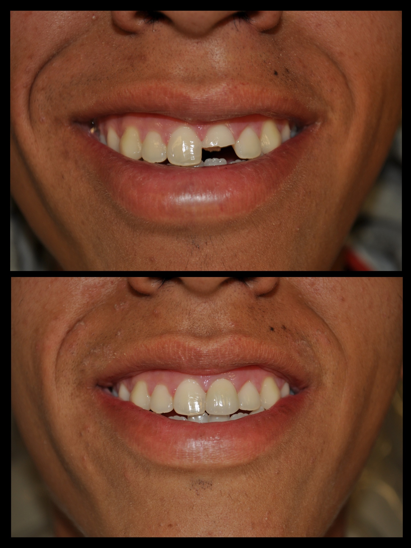 SDDS Dental Before and After 2
