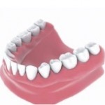 denture implants Bakersfield, CA