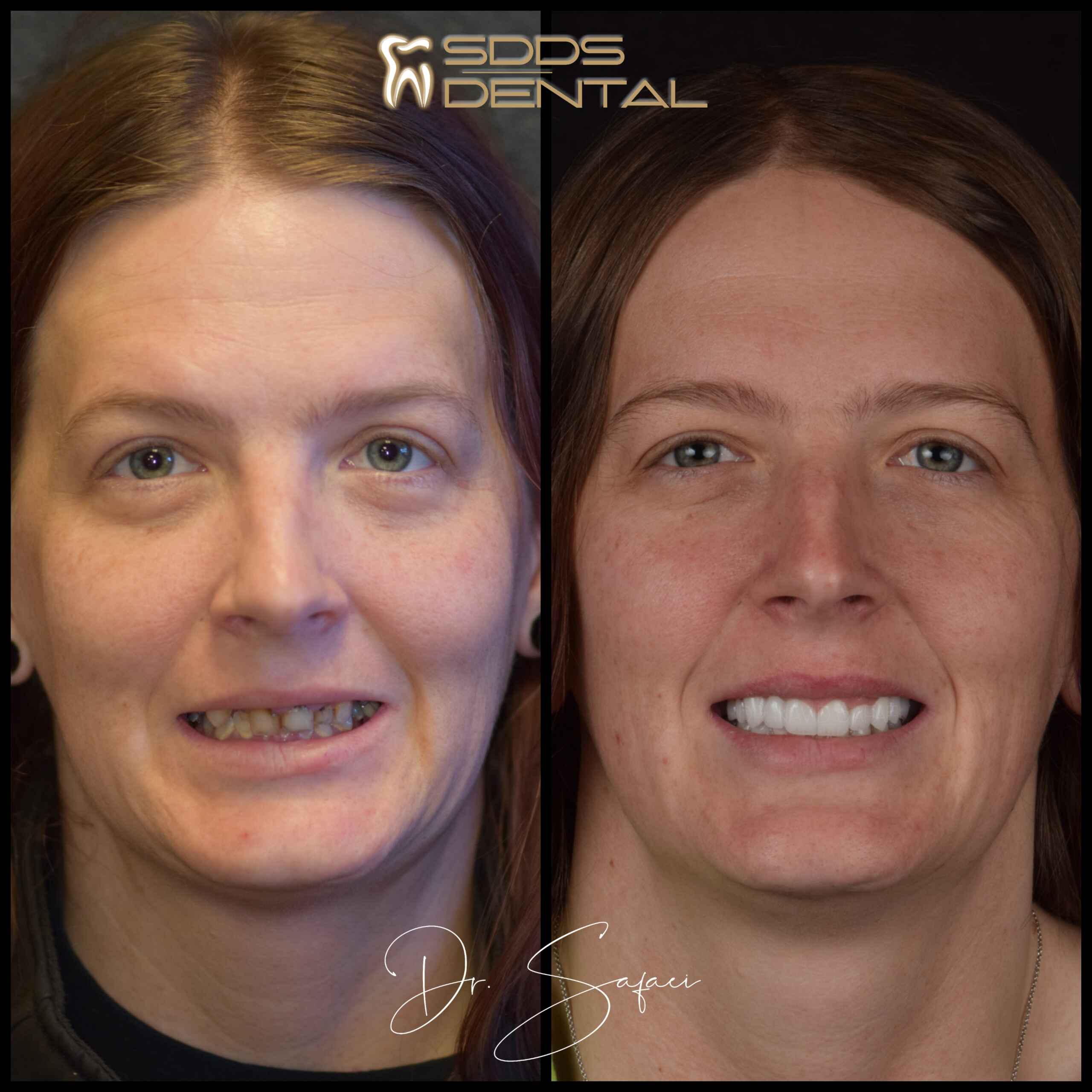 A women after dental treatment